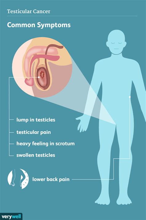 pain in the right testicle and lower back|late stage testicular cancer symptoms.